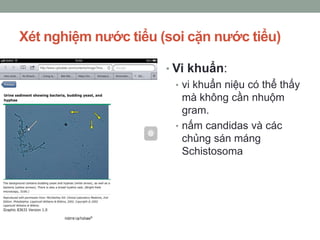 Xét nghiệm nước tiểu (soi cặn nước tiểu)
• Vi khuẩn:
• vi khuẩn niệu có thể thấy
mà không cần nhuộm
gram.
• nấm candidas và các
chủng sán máng
Schistosoma
 