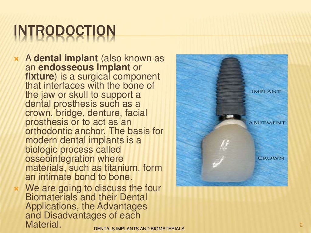 Dental implants and biomaterials