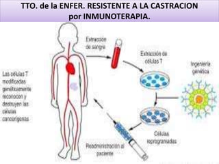 TTO. de la ENFER. RESISTENTE A LA CASTRACION
por INMUNOTERAPIA.
 