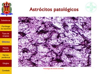 Histologia do tecido nervoso
Astrócitos patológicos
Substâncias
Morfologia
do neurônio
Tipos de
sinapses
Gliócitos
Medula
espinhal
Nervos
periféricos
Gânglios
Cerebelo
 