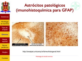 Histologia do tecido nervoso
Astrócitos patológicos
(imunohistoquímica para GFAP)
Substâncias
Morfologia
do neurônio
Tipos de
sinapses
Gliócitos
Medula
espinhal
Nervos
periféricos
Gânglios
Cerebelo
http://anatpat.unicamp.br/bineuhistogeral.html
 