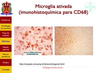 Histologia do tecido nervoso
Microglia ativada
(imunohistoquímica para CD68)
Substâncias
Morfologia
do neurônio
Tipos de
sinapses
Gliócitos
Medula
espinhal
Nervos
periféricos
Gânglios
Cerebelo
http://anatpat.unicamp.br/bineuhistogeral.html
 