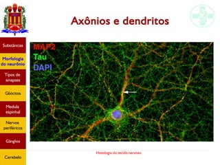 Histologia do tecido nervoso
Axônios e dendritos
Substâncias
Morfologia
do neurônio
Tipos de
sinapses
Gliócitos
Medula
espinhal
Nervos
periféricos
Gânglios
Cerebelo
 
