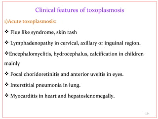 Clinical features of toxoplasmosis
1)Acute toxoplasmosis:
 Flue like syndrome, skin rash
 Lymphadenopathy in cervical, axillary or inguinal region.
Encephalomyelitis, hydrocephalus, calcification in children
mainly
 Focal choridoretinitis and anterior uveitis in eyes.
 Interstitial pneumonia in lung.
 Myocarditis in heart and hepatoslenomegally.
19
 