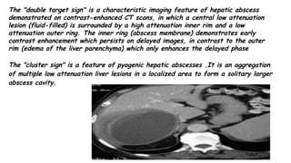 Comprehensive Guide to Triphasic MDCT for Liver Lesion Evaluation and ...