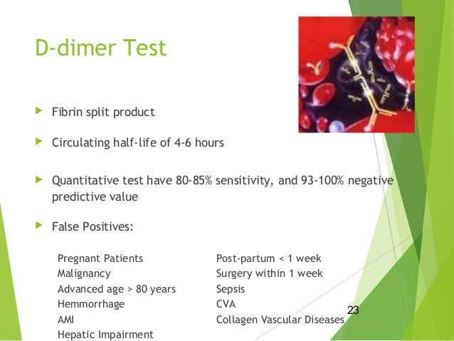 d heart disease dimer test and embolism pulmonary shah Xaheer d heart disease dimer test and embolism pulmonary shah Xaheer