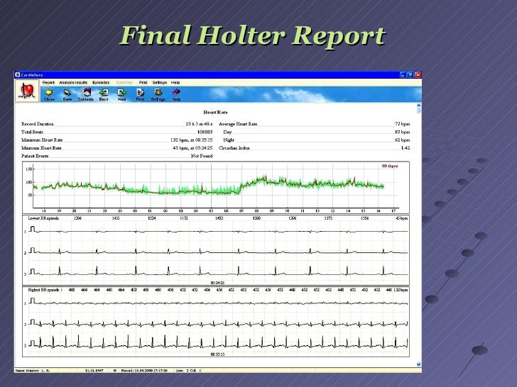 Heart rate experiments high school picture