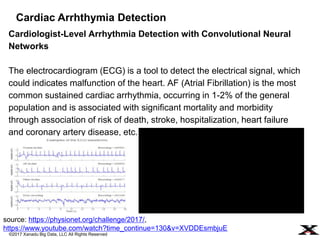 ©2017 Xanadu Big Data, LLC All Rights Reserved
Cardiologist-Level Arrhythmia Detection with Convolutional Neural
Networks
...