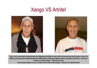 Xango VS Artrite!




Todo o seu corpo estava atacado pela dor. Nalgumas manhãs as suas mãos inchavam tanto que ficavam inúteis. Os
Médicos prescreveram medicamentos anti-inflamatórios. Depois de alguns meses a situação ainda ficou muito pior.
                                 Começou a tomar Xango – 120ml por dia (4x).
           Uma semana depois a sua cor voltou, tinha muito mais energia e reduziu os medicamentos!
 