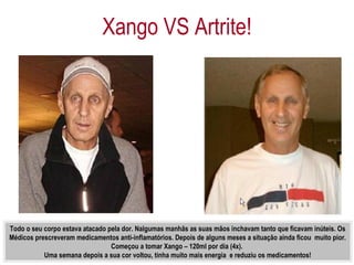 Xango VS Artrite! Todo o seu corpo estava atacado pela dor. Nalgumas manhãs as suas mãos inchavam tanto que ficavam inúteis. Os Médicos prescreveram medicamentos anti-inflamatórios. Depois de alguns meses a situação ainda ficou  muito pior. Começou a tomar Xango – 120ml por dia (4x).  Uma semana depois a sua cor voltou, tinha muito mais energia  e reduziu os medicamentos! 