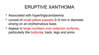 Comprehensive Overview of Xanthoma Types, Causes, and Histology | PPTX