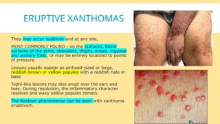 XANTHOMAS and ABNORMALITIES OF LIPID METABOLISM AND STORAGE.pptx
