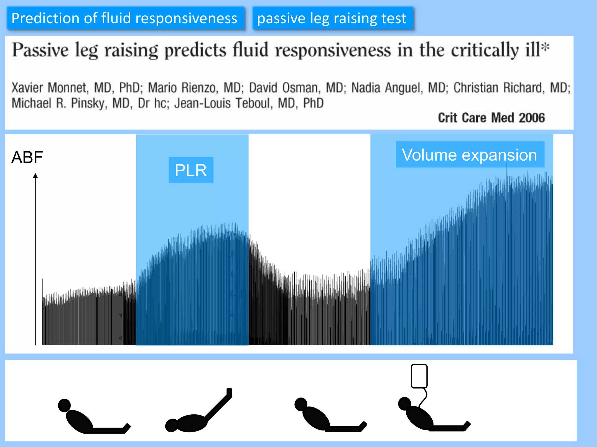 ABF
PLR
Volume expansion
Prediction of fluid responsiveness passive leg raising test
 