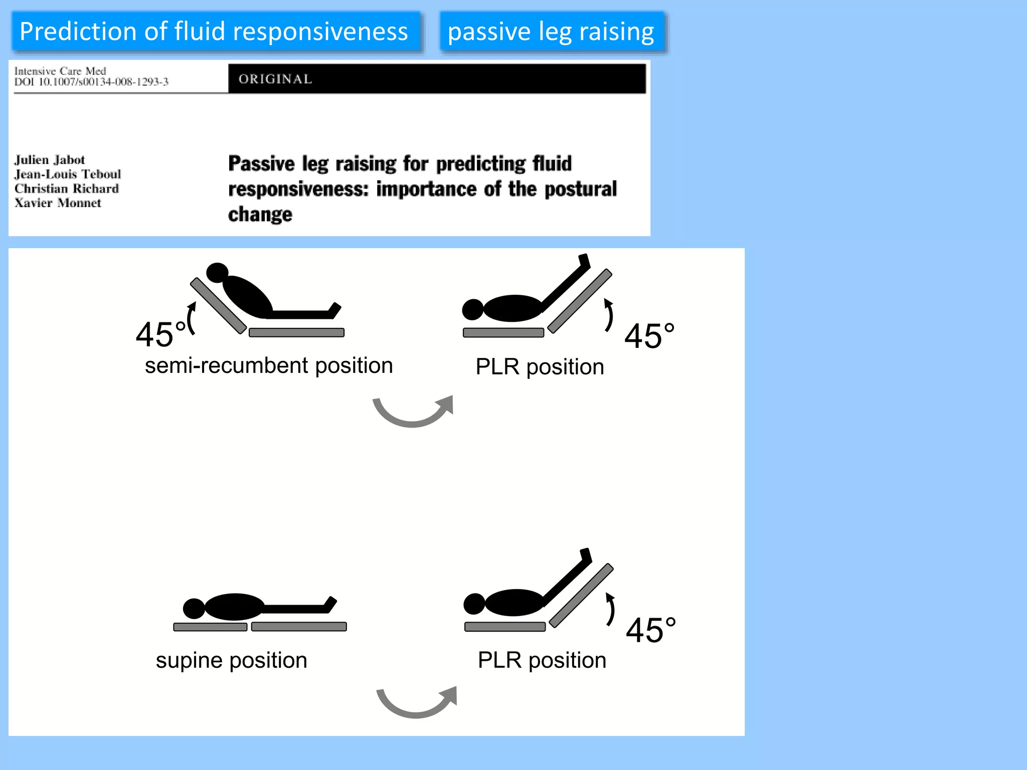 semi-recumbent position PLR position
45° 45°
45°
PLR positionsupine position
Prediction of fluid responsiveness passive leg raising
 