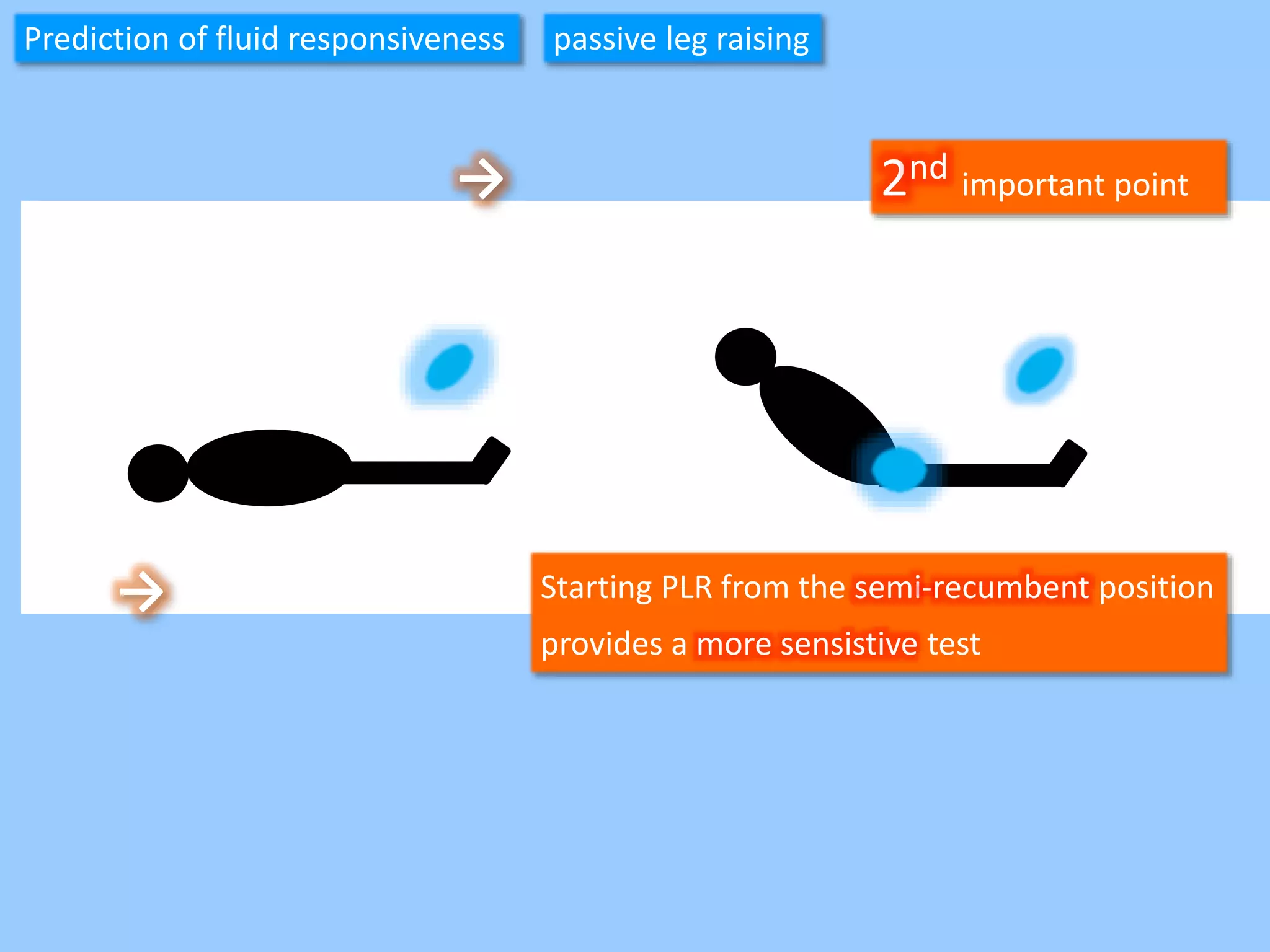 Prediction of fluid responsiveness passive leg raising
Starting PLR from the semi-recumbent position
provides a more sensistive test
→
2nd important point→
 