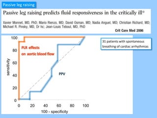 Assessment of fluid responsiveness Beyond PPV | PPTX