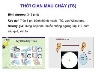 THỜI GIAN MÁU CHẢY (TS)
Bình thường: 3- 6 phút
Kéo dài: Trên 6 ph: bệnh thành mạch - TC, von Willebrand.
Dương giả: Dùng Aspirine, thuốc chống ngưng tập TC, đâm
sâu quá, kim to
 