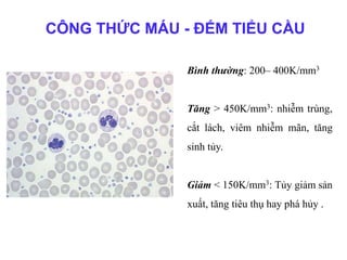 CÔNG THỨC MÁU - ĐẾM TIỂU CẦU
Bình thường: 200– 400K/mm3
Tăng > 450K/mm3: nhiễm trùng,
cắt lách, viêm nhiễm mãn, tăng
sinh tủy.
Giảm < 150K/mm3: Tủy giảm sản
xuất, tăng tiêu thụ hay phá hủy .
 