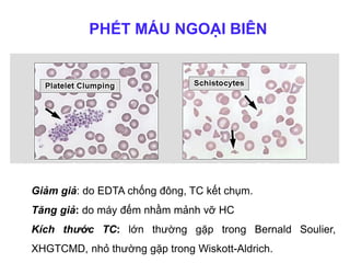 PHẾT MÁU NGOẠI BIÊN
Giảm giả: do EDTA chống đông, TC kết chụm.
Tăng giả: do máy đếm nhầm mảnh vỡ HC
Kích thước TC: lớn thường gặp trong Bernald Soulier,
XHGTCMD, nhỏ thường gặp trong Wiskott-Aldrich.
 