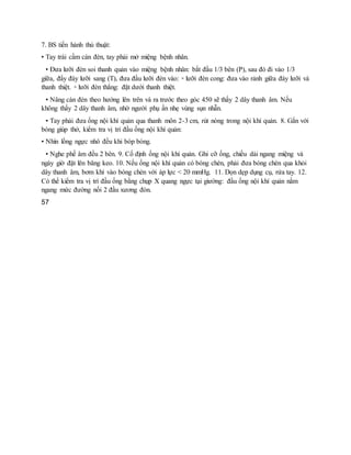 7. BS tiến hành thủ thuật:
• Tay trái cầm cán đèn, tay phải mở miệng bệnh nhân.
• Đưa lưỡi đèn soi thanh quản vào miệng bệnh nhân: bắt đầu 1/3 bên (P), sau đó đi vào 1/3
giữa, đẩy đáy lưỡi sang (T), đưa đầu lưỡi đèn vào: ▫ lưỡi đèn cong: đưa vào rảnh giữa đáy lưỡi và
thanh thiệt. ▫ lưỡi đèn thẳng: đặt dưới thanh thiệt.
• Nâng cán đèn theo hướng lên trên và ra trước theo góc 450 sẽ thấy 2 dây thanh âm. Nếu
không thấy 2 dây thanh âm, nhờ người phụ ấn nhẹ vùng sụn nhẫn.
• Tay phải đưa ống nội khí quản qua thanh môn 2-3 cm, rút nòng trong nội khí quản. 8. Gắn với
bóng giúp thở, kiểm tra vị trí đầu ống nội khí quản:
• Nhìn lồng ngực nhô đều khi bóp bóng.
• Nghe phế âm đều 2 bên. 9. Cố định ống nội khí quản. Ghi cỡ ống, chiều dài ngang miệng và
ngày giờ đặt lên băng keo. 10. Nếu ống nội khí quản có bóng chèn, phải đưa bóng chèn qua khỏi
dây thanh âm, bơm khí vào bóng chèn với áp lực < 20 mmHg. 11. Dọn dẹp dụng cụ, rửa tay. 12.
Có thể kiểm tra vị trí đầu ống bằng chụp X quang ngực tại giường: đầu ống nội khí quản nằm
ngang mức đường nối 2 đầu xương đòn.
57
 