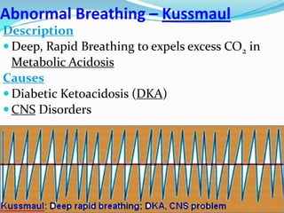 Abnormal Breathing – Kussmaul
Description
 Deep, Rapid Breathing to expels excess CO2 in
Metabolic Acidosis
Causes
 Diabetic Ketoacidosis (DKA)
 CNS Disorders
 