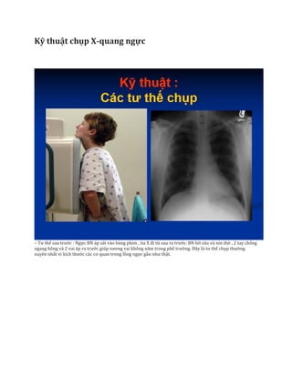 Kỹ thuật chụp X-quang ngực
– Tư thế sau trước : Ngực BN áp sát vào bảng phim , tia X đi từ sau ra trước. BN hít sâu và nín thở , 2 tay chống
ngang hông và 2 vai áp ra trước giúp xương vai không năm trong phế trường. Đây là tư thế chụp thường
xuyên nhất vì kích thước các cơ quan trong lồng ngực gần như thật.
 