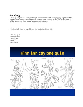 Nội dung:
– Bài này cung cấp cho các bạn những kiến thức cơ bản về X-quang ngực, giải phẫu hô hấp,
cây phế quản, hướng dẫn các bạn cách đọc một phim X-quang cơ bản, thứ tự đọc phim x-
quang, những dấu hiệu cơ bản trên phim X-quang ngực.
– Nhắc lại giải phẫu hô hấp: Các bạn cần lưu ý đến các chi tiết:
+ Khí phế quản
+ Nhu mô phổi
+ Trung thất
+ Tim
+ Mạch máu
 