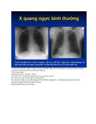 – Trước khi phân tích 1 phim x quang , cần lưu ý tên BN , ngày sinh , khoa phòng , và luôn luôn kiểm tra ngày
chụp phim và sắp xếp theo thứ tự từ trước đến nay.
– Yêu cầu kỹ thuật :
Khoảng cách phim – đầu đèn : 185cm
Hít vào đủ sâu : vòm hoành ngang mức cung sau xương sường 9
Cân xứng : mỏm gai T3 nằm giữa hai khớp ức đòn
Tia vừa đủ : thấy rõ các đốt sống từ T4 trở lên , bóng tim , cơ hoành mạch máu sắc nét
Xương vai phải tách khỏi phế trường
Búi tóc phải bới cao trên đầu …
 