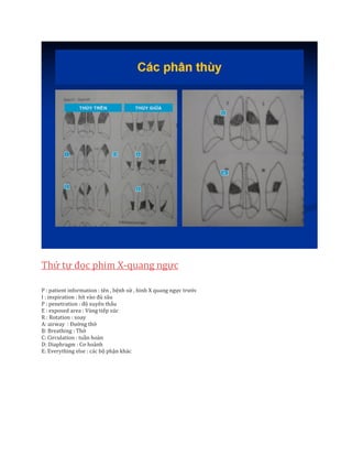 Thứ tự đọc phim X-quang ngực
P : patient information : tên , bệnh sử , hình X quang ngực trước
I : inspiration : hít vào đủ sâu
P : penetration : độ xuyên thấu
E : exposed area : Vùng tiếp xúc
R : Rotation : xoay
A: airway : Đường thở
B: Breathing : Thở
C: Circulation : tuần hoàn
D: Diaphragm : Cơ hoành
E: Everything else : các bộ phận khác
 