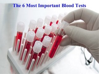 The 6 Most Important Blood Tests
 