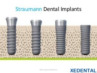 Straumann Dental Implants
https://www.xedental.com
 
