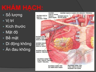 KHÁM HẠCH:
 Số lượng
 Vị trí
 Kích thước
 Mật độ
 Bề mặt
 Di động không
 Ấn đau không
 