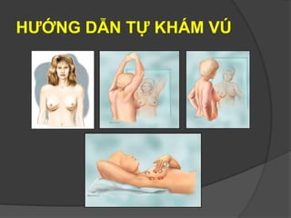HƯỚNG DẪN TỰ KHÁM VÚ
 