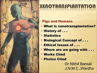 Pigs and Humans
   What is xenotransplantation?
   History of . . .
   Statistics
   Biological Concept of . . .
   Ethical Issues of . . .
   Where are we going with . . .
   Works Cited
   Photos Cited
               Dr Nikhil Bansal
               J.N.M.C.,Wardha
 