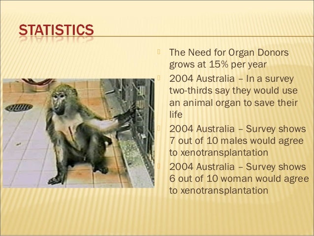 Combine powerpoint presentation xenotransplantation