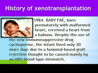 History of xenotransplantation in ethics