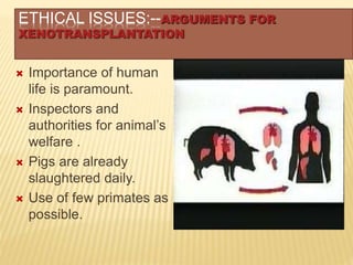 ETHICAL ISSUES:--ARGUMENTS FOR
XENOTRANSPLANTATION
 Importance of human
life is paramount.
 Inspectors and
authorities for animal’s
welfare .
 Pigs are already
slaughtered daily.
 Use of few primates as
possible.
 