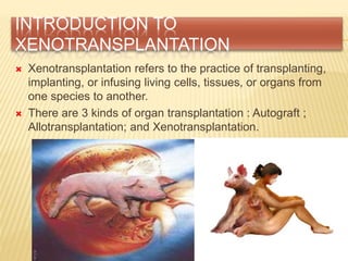 INTRODUCTION TO
XENOTRANSPLANTATION
 Xenotransplantation refers to the practice of transplanting,
implanting, or infusing living cells, tissues, or organs from
one species to another.
 There are 3 kinds of organ transplantation : Autograft ;
Allotransplantation; and Xenotransplantation.
 