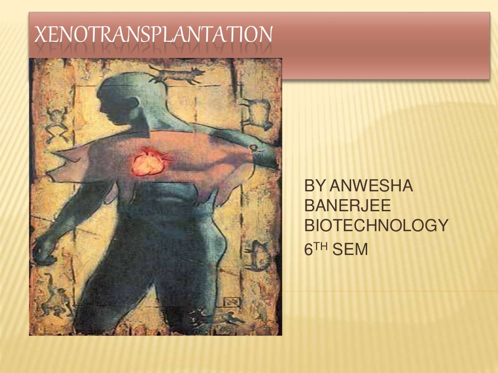 Xenotransplantation