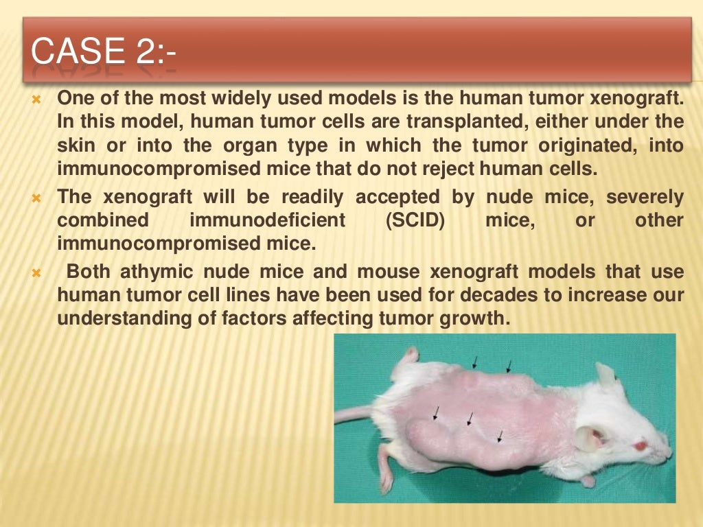 Xenotransplantation