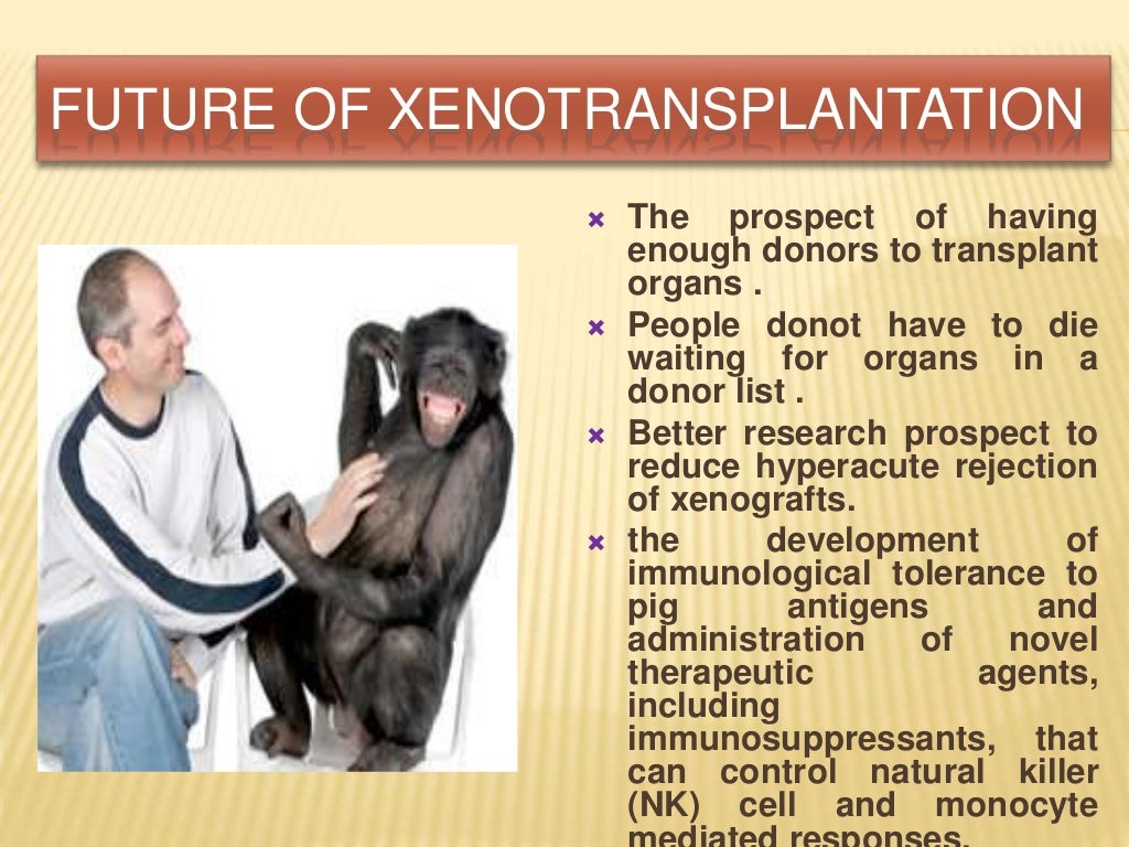 Xenotransplantation