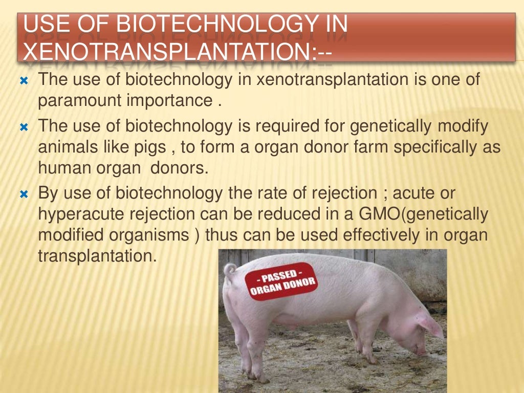 Xenotransplantation
