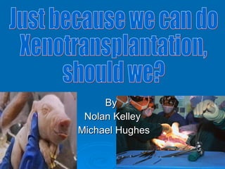 By  Nolan Kelley Michael Hughes Just because we can do Xenotransplantation, should we? 