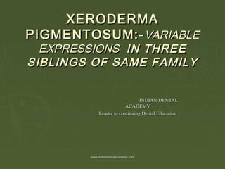 XERODERMAXERODERMA
PIGMENTOSUM:-PIGMENTOSUM:-VARIABLEVARIABLE
EXPRESSIONSEXPRESSIONS IN THREEIN THREE
SIBLINGS OF SAME FAMILYSIBLINGS OF SAME FAMILY
INDIAN DENTALINDIAN DENTAL
ACADEMYACADEMY
Leader in continuing Dental EducationLeader in continuing Dental Education
www.indiandentalacademy.comwww.indiandentalacademy.com
 