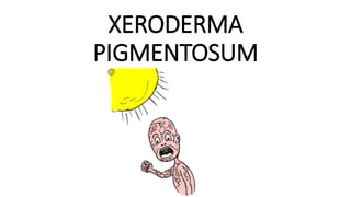XERODERMA
PIGMENTOSUM
 