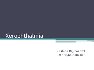 Xerophthalmia
-Kshitiz Raj Pokhrel
-MBBS,KUSMS DH
 