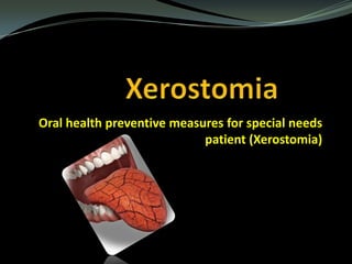 Oral health preventive measures for special needs
patient (Xerostomia)

 