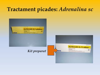 Tractament picades: Adrenalina sc
Kit preparat
 