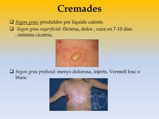 Cremades
 Segon grau: produïdes per líquids calents
 Segon grau superficial: flictena, dolor , cura en 7-10 dies
, mínima cicatriu.
 Segon grau profund: menys dolorosa, injerts. Vermell fosc o
blanc
 