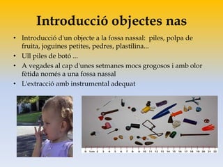 Introducció objectes nas
• Introducció d'un objecte a la fossa nassal: piles, polpa de
fruita, joguines petites, pedres, plastilina...
• Ull piles de botó ...
• A vegades al cap d'unes setmanes mocs grogosos i amb olor
fètida només a una fossa nassal
• L'extracció amb instrumental adequat
 